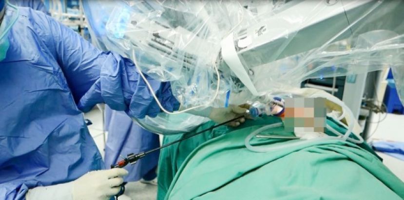 泌尿外科好助手 达文西手臂精准下刀