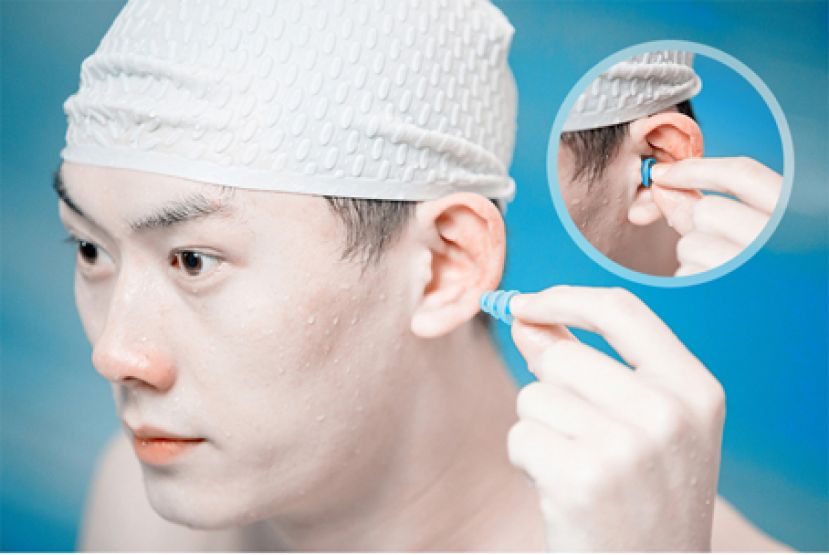 避免霉菌感染致发炎风险 戴耳塞防&ldquo;游水耳&rdquo;
