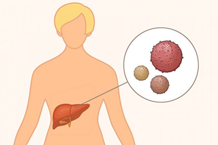 三种肝炎可成肝癌推手 关于肝炎你要知道的事