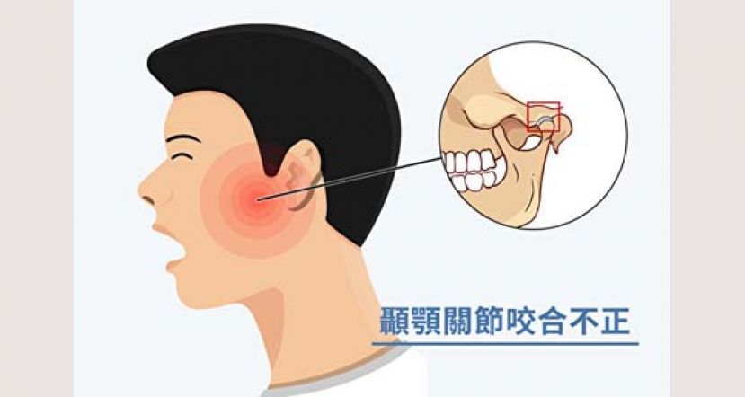 咬合不正身体也变歪？ 注意12点矫正颞颚关节