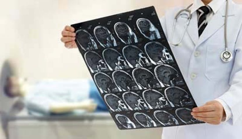 头痛必是脑瘤警讯？ 医：机率偏低