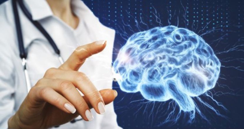 颅内动静脉畸形30%病人恐致癫痫