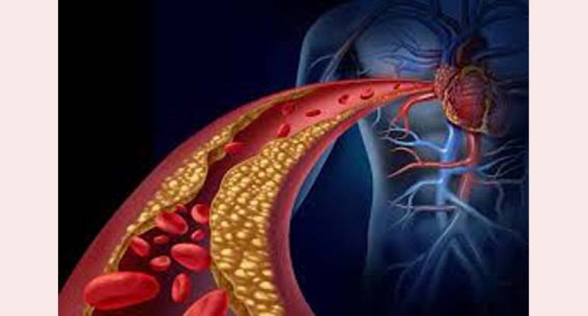 血管疾病不容忽视　主动脉周边血管新科技 治疗再升级