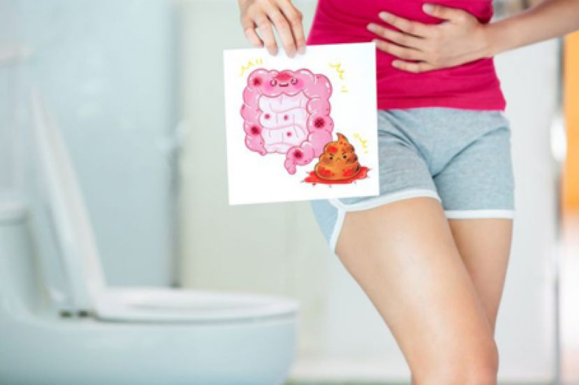 腹泻、便秘好苦恼　药师教你吃益生菌