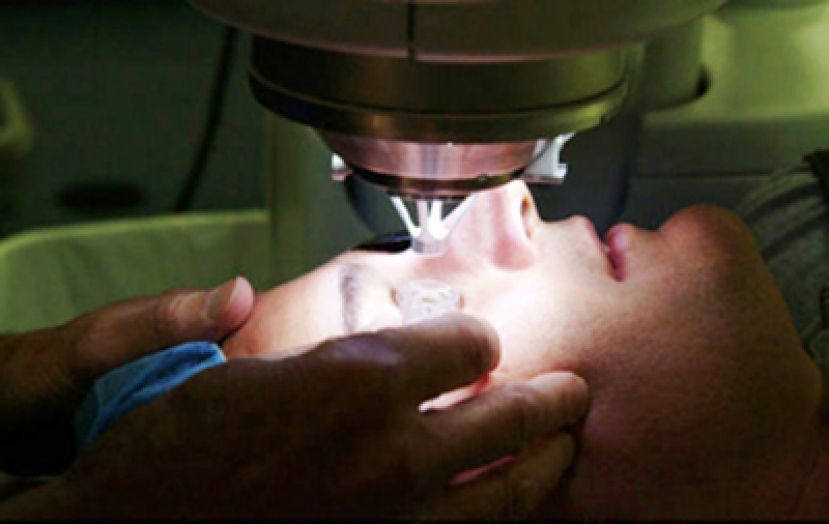 不想戴眼镜！雷射术后白内障该怎么办？