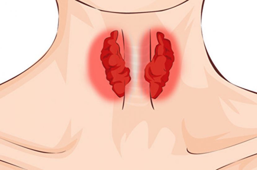 这些症状当心甲状腺亢进 三方法与它和平共处