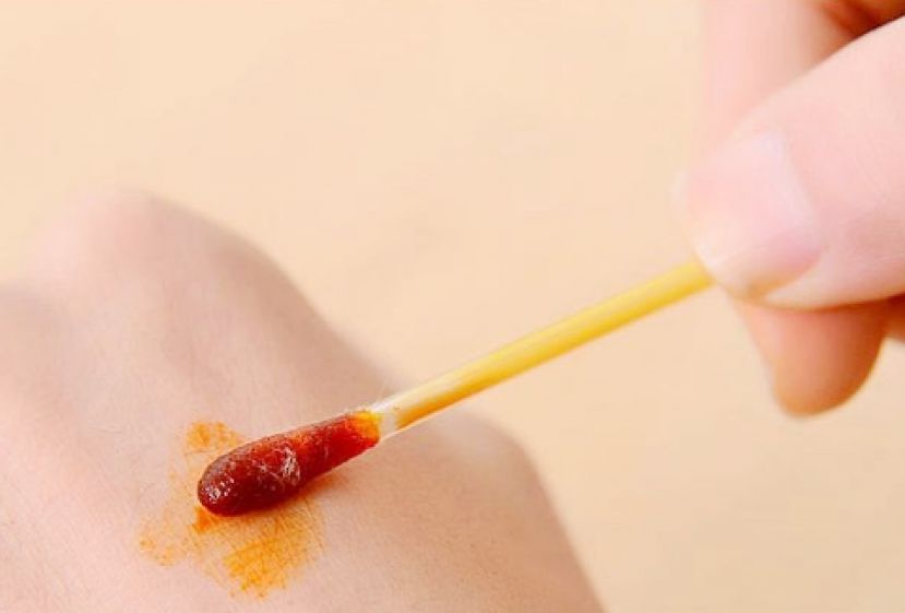 鱼刺小伤口 竟并发筋膜坏死险休克！