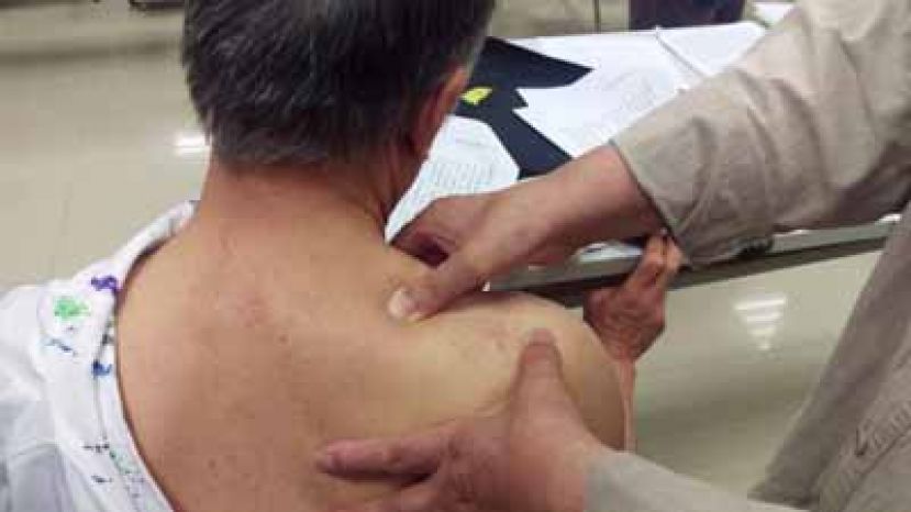 酸痛别乱推拿！医：乔颈椎不当恐瘫