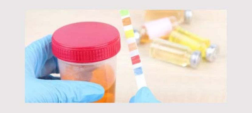 茶色小便切勿忽视 可能是肝胆病征兆