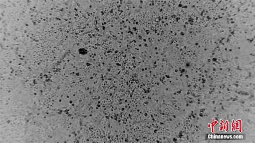 澳科学家成功培育出新型冠状病毒样本