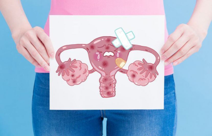 妇女杀手卵巢癌易复发  口服标靶药助续命