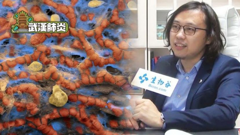 左为的研究发现，新型冠状病毒会先攻击肺泡。