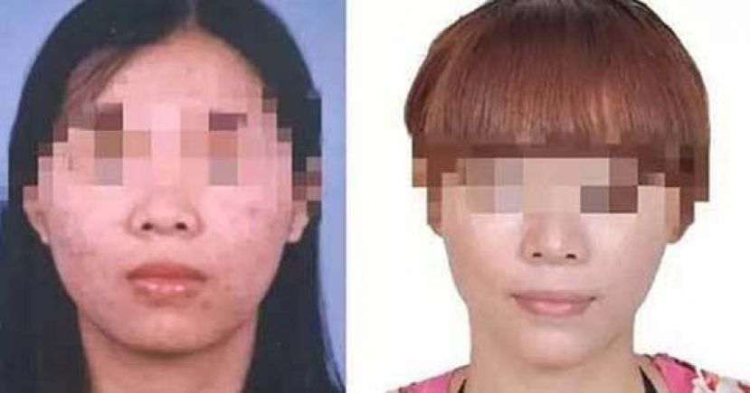 女子挪用公款逃了16年，换脸整形还是被逮捕。