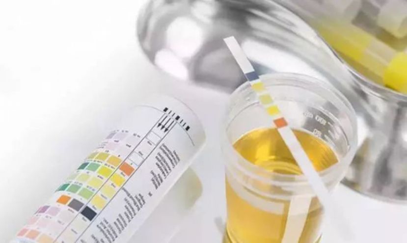 小便气味中的健康密码